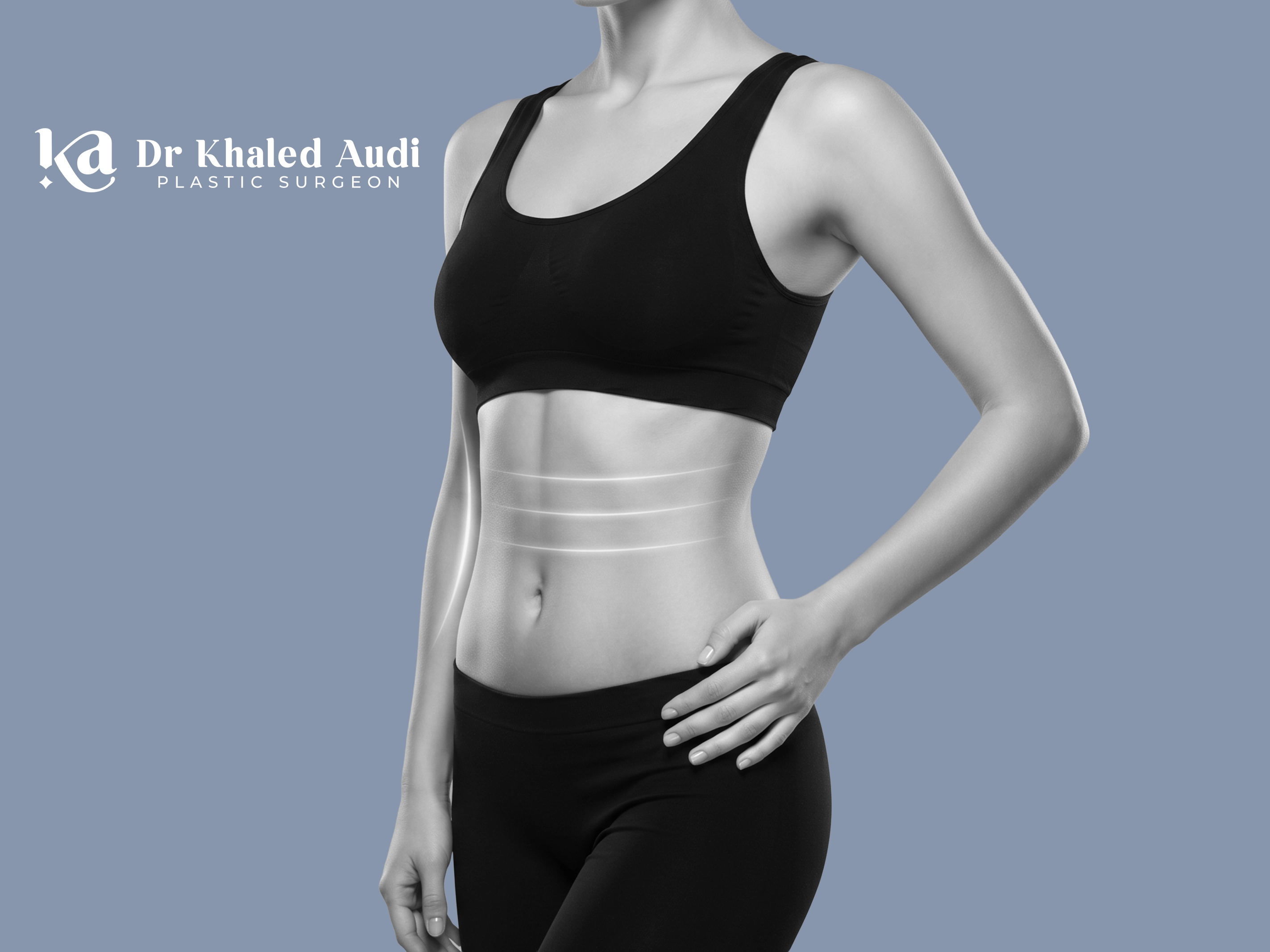 -ش- البطن-Tummy-Tuck